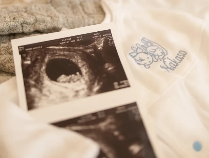 妊娠初期または中期のエコー写真と、産院名または赤ちゃんの名前が刺繍された白い肌着。