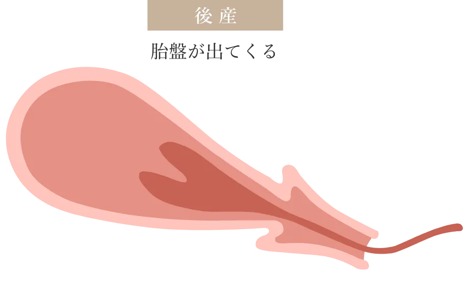 出産後の胎盤のイラスト