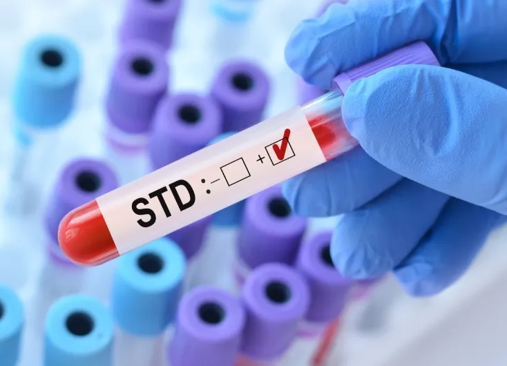 青い手袋をはめた手が、赤いキャップの試験管を持っているクローズアップ。試験管には『STD』の文字と、陽性（＋）のチェックマークが見える。性感染症（STD）の検査のイメージ。
